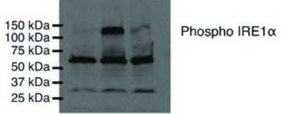 Detection of phosphorylated IRE-1 alpha using NB100-2323. Lane 1: COS-7 untransfected Lane 2: COS-7 expressing wild-type IRE1 alpha Lane 3: COS-7 expressing kinase-dead IRE1 alpha.